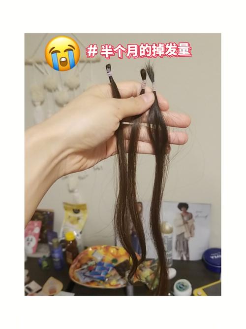 2025新澳门天天开好彩.和因发量太多剃掉头发与因发量太多剃掉头发会怎么样